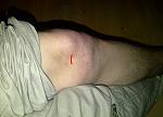 knie.jpg