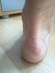 IMG_20120619_145141.jpg