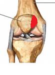 Patella Schmerz.jpg