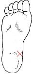 Fuss.jpg