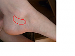 Fuß.png