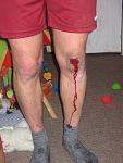 Sturz_14_02_09_2_1.JPG