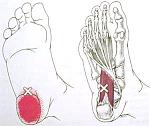 Quadratus_plantae[1].jpg