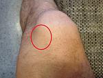 knie.JPG