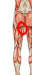 hamstring-origin-tendinopat.jpg