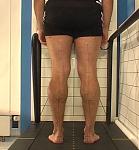 Beinachsen.JPG