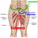 adduktorenschmerz.jpg