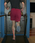 überpronation.png