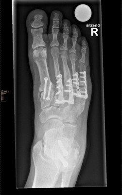 C.H. Seq.1 X Fuss dp re stehend.jpg