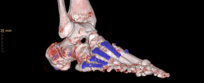 C.H. Seq.1005 3D ohne Namen.jpg